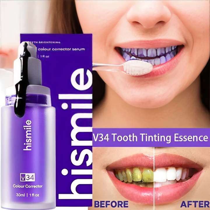 Hismile Teeth Whitening