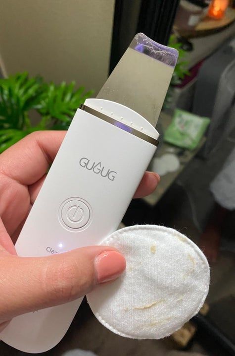 Electric blackhead pore remover