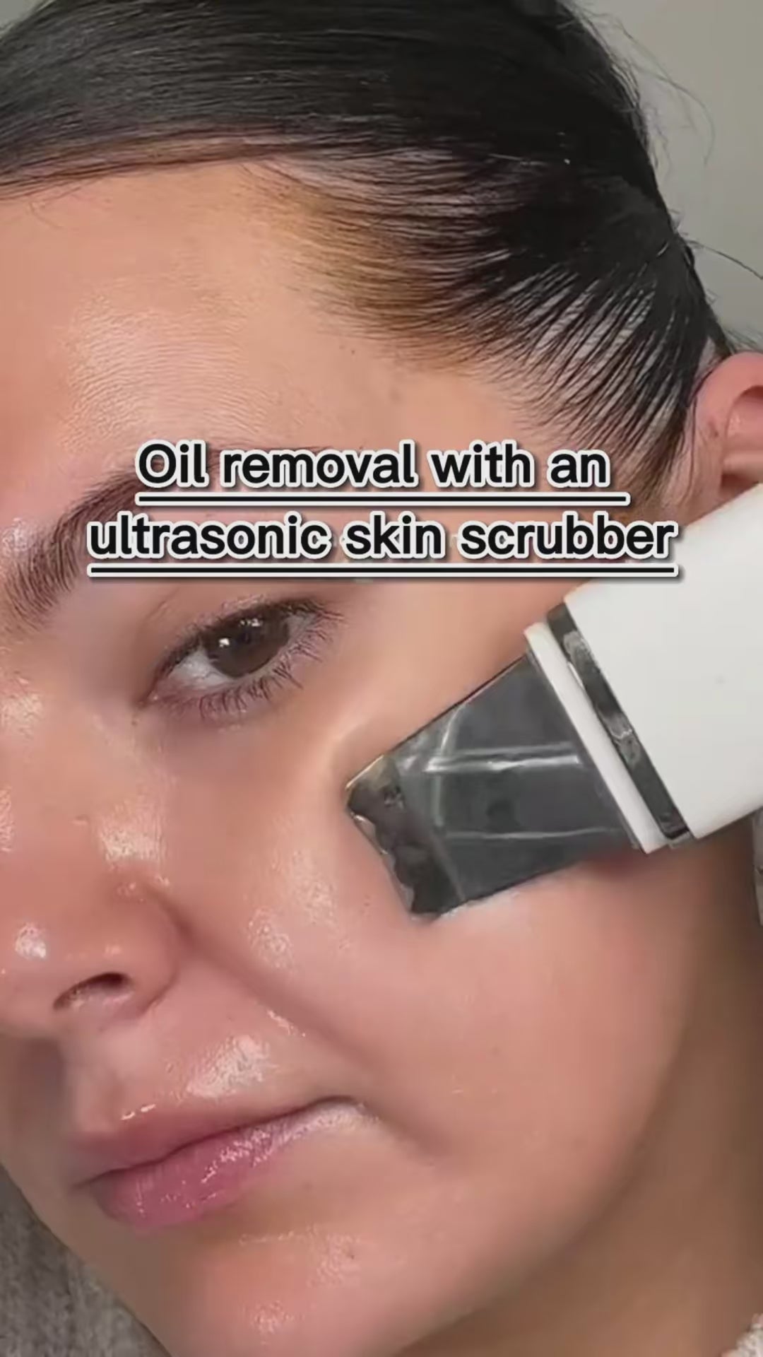 Electric blackhead pore remover